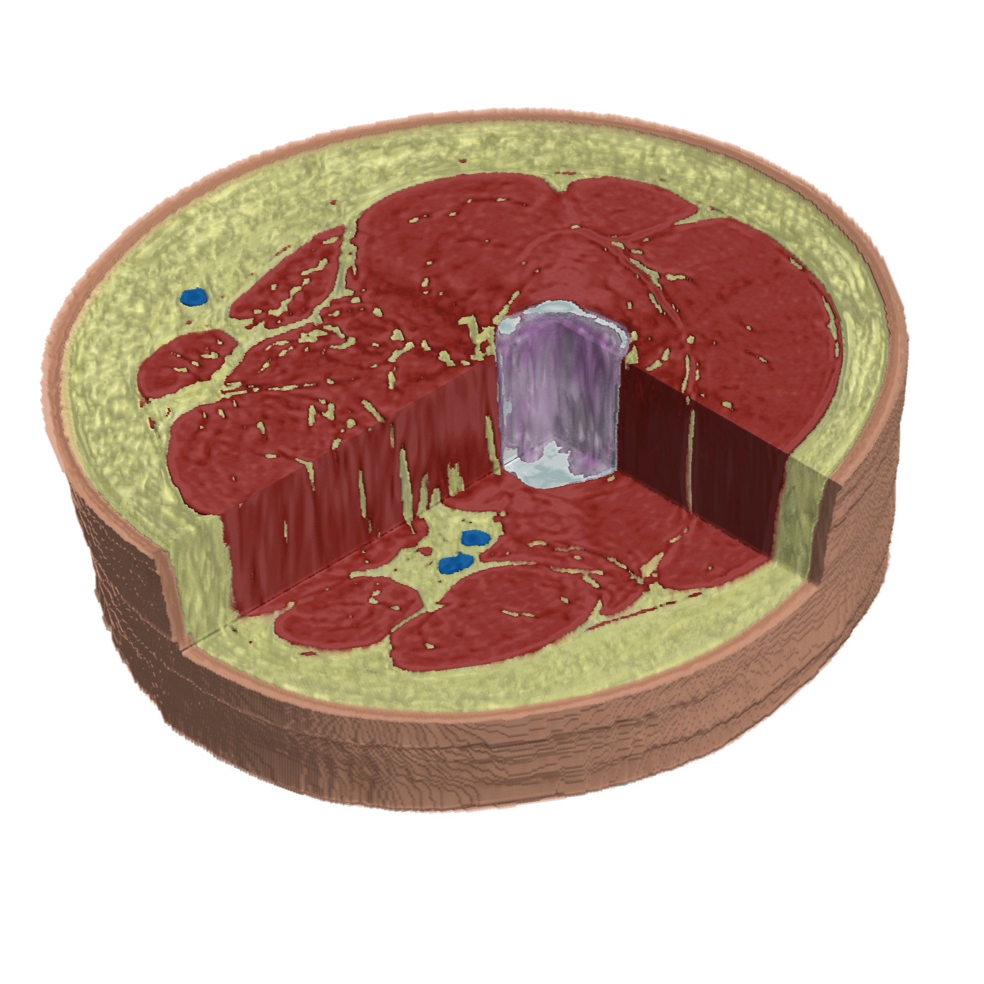 Ultrasound tomography of musculoskeletal tissues